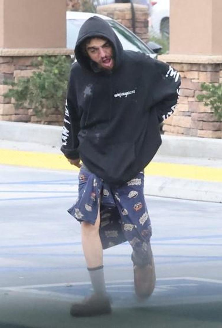 Bir dönemin çocuk yıldızının trajik düşüşü Sokaklarda yaşadığı ortaya çıktı