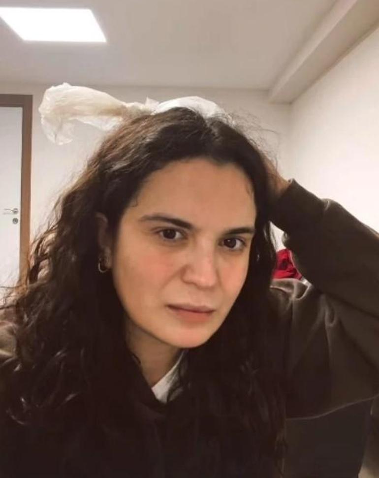 Sahnede kaza geçirdi Aslı Bekiroğlunun kafasına kapı düştü