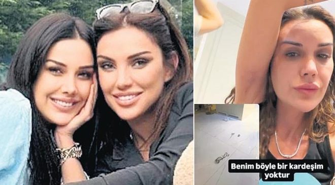 Yolunmuş saçlarını paylaştı