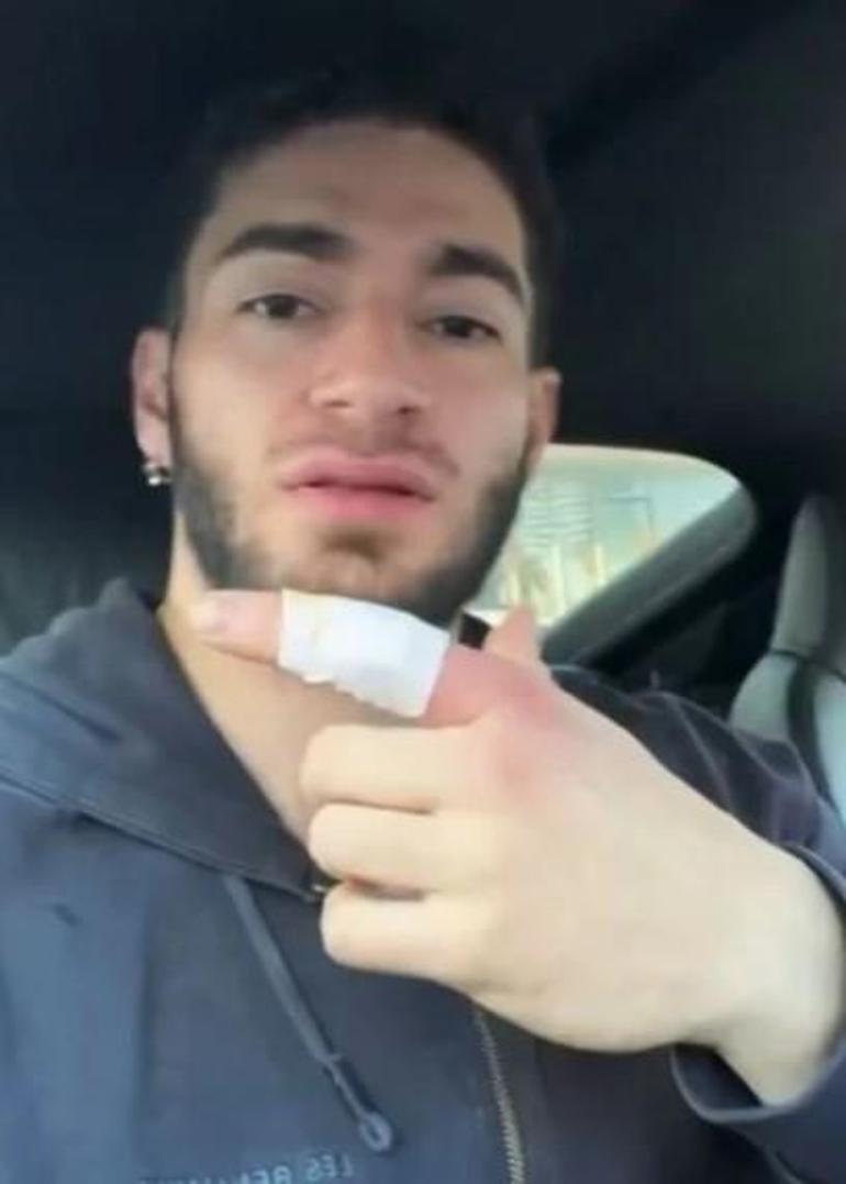 YouTuber Testo Taylanı köpek ısırdı Kemiğimde hissettim