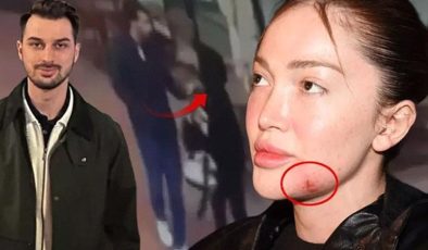 Fenomen Danla Biliç’i darbeden eski sevgilinin cezası belli oldu