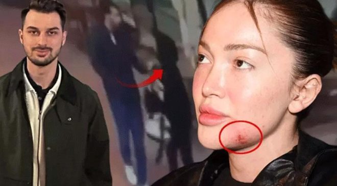 Fenomen Danla Biliç’i darbeden eski sevgilinin cezası belli oldu