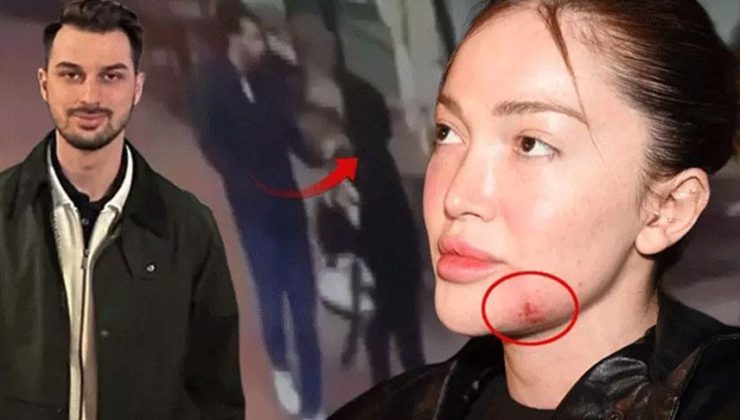 Fenomen Danla Biliç’i darbeden eski sevgilinin cezası belli oldu