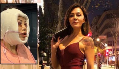 Kore'de yüz nakli yaptırmıştı! Didem Ceran hastalığını ilk kez açıkladı: Saklamak istemiyorum