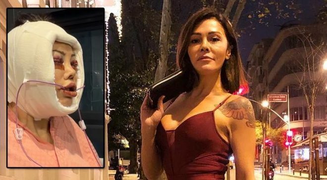 Kore'de yüz nakli yaptırmıştı! Didem Ceran hastalığını ilk kez açıkladı: Saklamak istemiyorum
