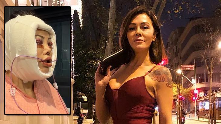 Kore'de yüz nakli yaptırmıştı! Didem Ceran hastalığını ilk kez açıkladı: Saklamak istemiyorum