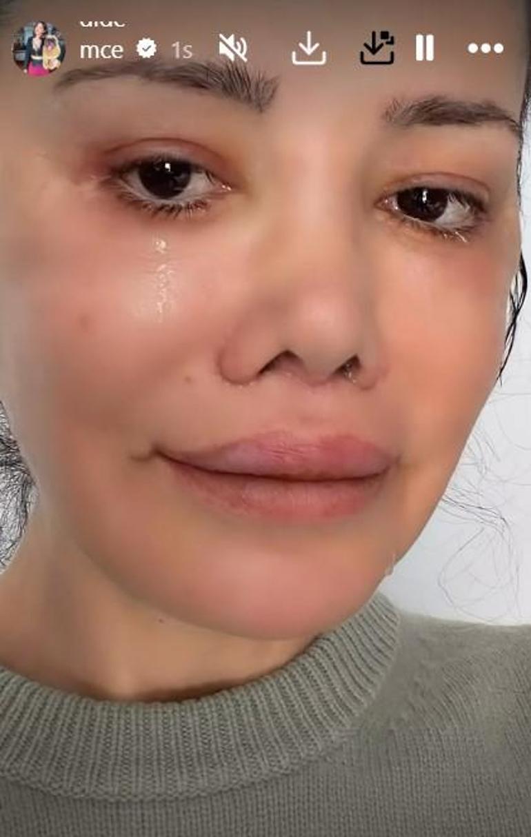 Korede yüz nakli yaptırmıştı Didem Ceran hastalığını ilk kez açıkladı: Saklamak istemiyorum