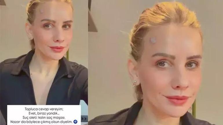 Canlı yayın öncesi talihsiz kaza Esra Erolun yüzü yandı