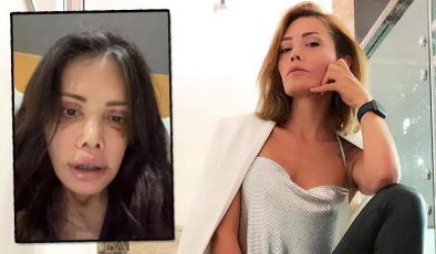 Didem Ceran'dan şoke eden paylaşım: Yüzü nakledilen kişinin alnı kaşıma denk geldi!