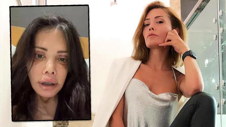 Didem Ceran'dan şoke eden paylaşım: Yüzü nakledilen kişinin alnı kaşıma denk geldi!