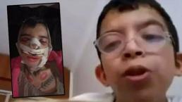 'Tablet Reis' olarak tanınmıştı: Değişimi şoke etti! Eleştiriler yüzünden ameliyat masasına yattı