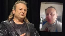 'Et yiyen bakteri' ile mücadele ediyor: Onur Akay entübe edildi!