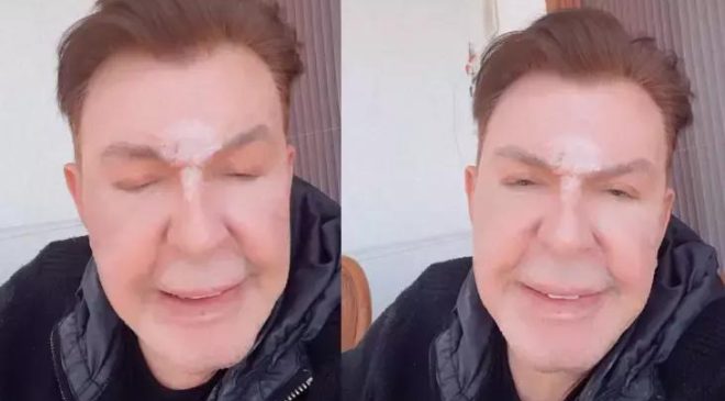 Yüzünü gerdiren Kuşum Aydın isyan etti: Benden bu kadar!