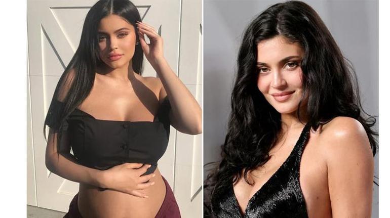 Kylie Jenner hastalığını ilk kez açıkladı Hayatım durma noktasına geldi, yürüyemiyordum