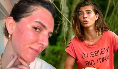 Survivor Merve Aydın’ın değişimi şaşırttı! Yüzüne yaptırdığı işlemi tek tek anlattı
