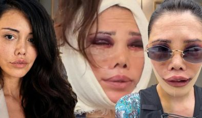İkinci kez yüz nakli olmuştu! Didem Ceran’dan peş peşe çarpıcı açıklamalar: Hiç kimsem yok, tek başıma savaşıyorum