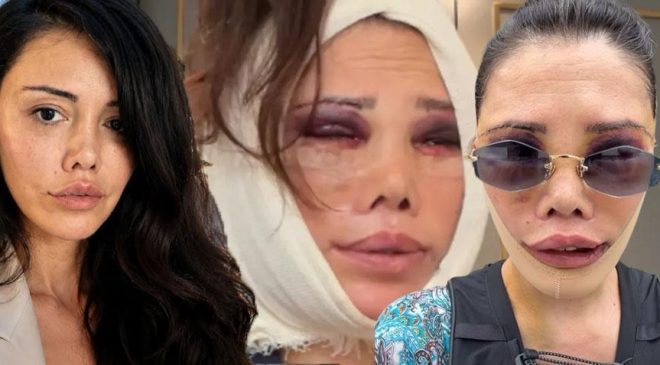 İkinci kez yüz nakli olmuştu! Didem Ceran’dan peş peşe çarpıcı açıklamalar: Hiç kimsem yok, tek başıma savaşıyorum