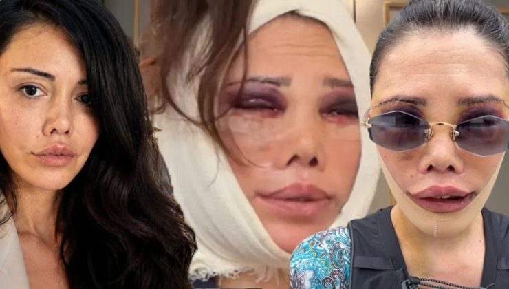 İkinci kez yüz nakli olmuştu! Didem Ceran’dan peş peşe çarpıcı açıklamalar: Hiç kimsem yok, tek başıma savaşıyorum